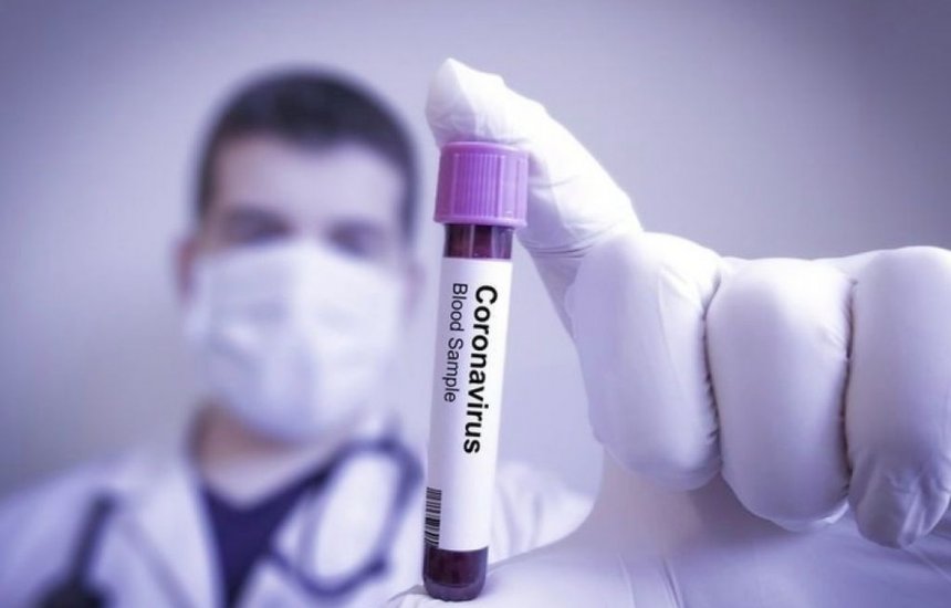 [Sesab contabiliza 30 casos confirmados de coronavírus na Bahia]