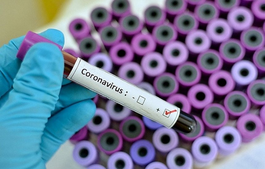 [Estudo indica que remédio contra piolhos é capaz de matar coronavírus em 48h]
