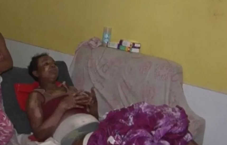 [Mulher pede ajuda após ter 70% do corpo queimado enquanto cozinhava com álcool na Bahia]