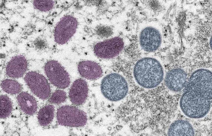 [8º caso de varíola dos macacos é confirmado no Brasil]